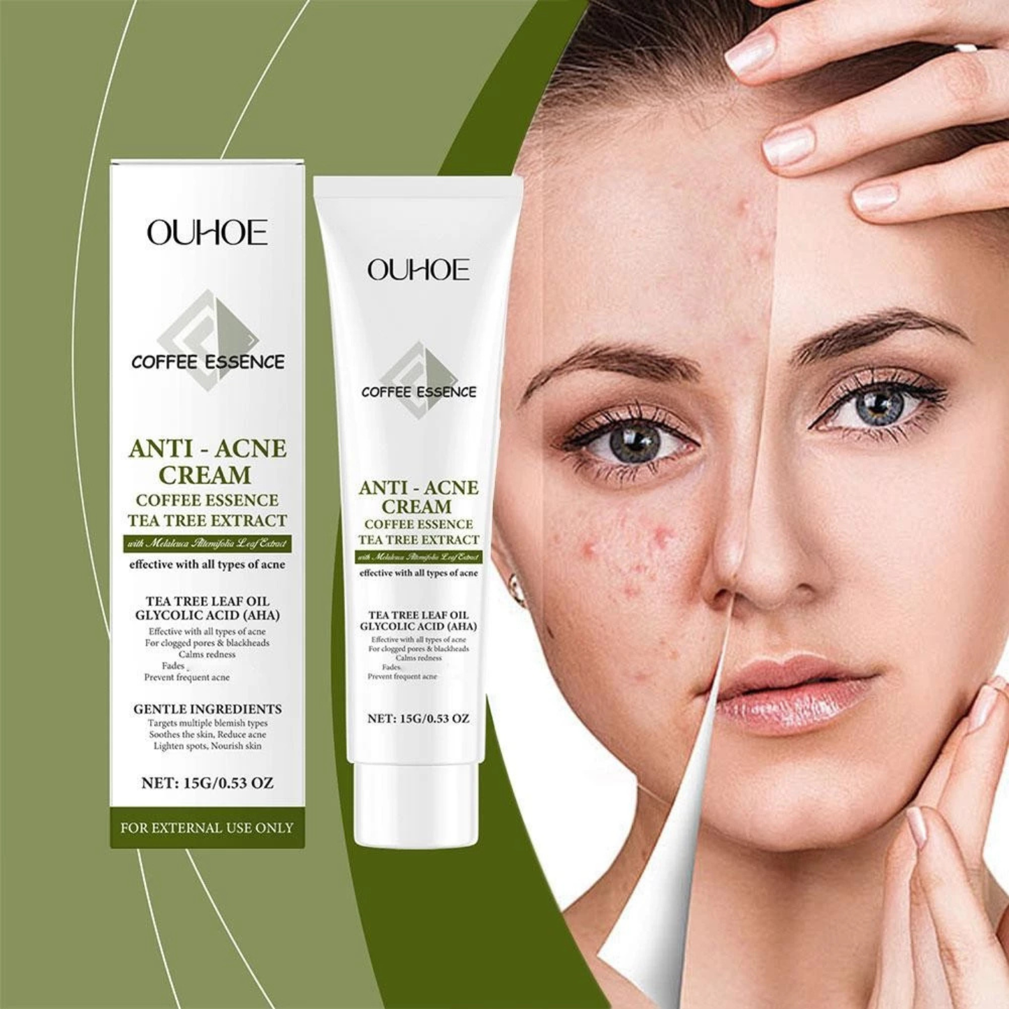Cremă Profesională Anti-Acnee cu Extract de Arbore de Ceai și Acid Glicolic