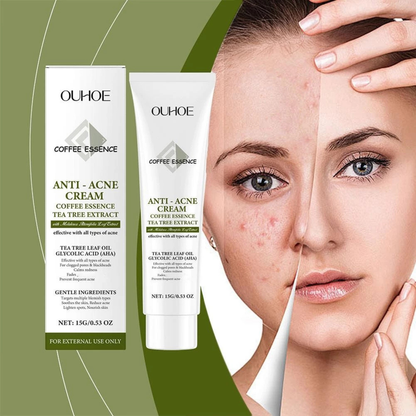 Cremă Profesională Anti-Acnee cu Extract de Arbore de Ceai și Acid Glicolic