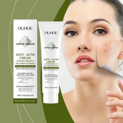 Cremă Profesională Anti-Acnee cu Extract de Arbore de Ceai și Acid Glicolic