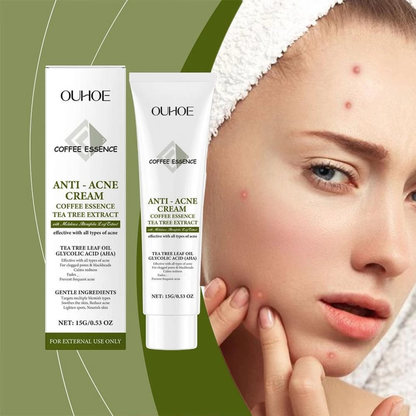 Cremă Profesională Anti-Acnee cu Extract de Arbore de Ceai și Acid Glicolic