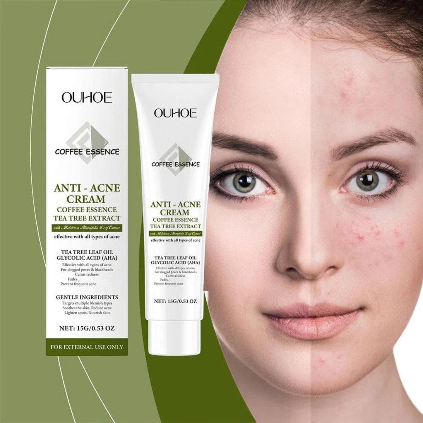 Cremă Profesională Anti-Acnee cu Extract de Arbore de Ceai și Acid Glicolic