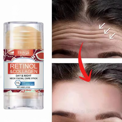 Retinol Stick – Cremă Anti-Aging Pentru o Piele Fermă Și Strălucitoare