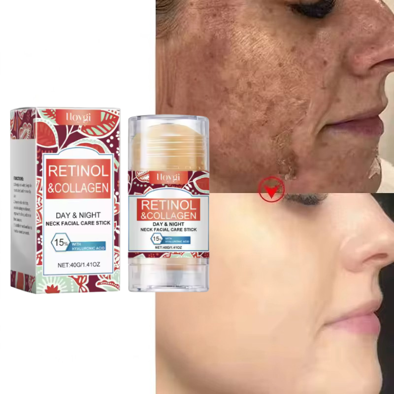 Retinol Stick – Cremă Anti-Aging Pentru o Piele Fermă Și Strălucitoare